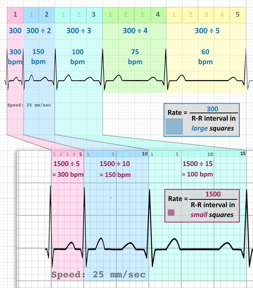 approach-to-ecg-cardioschool